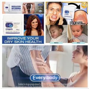 [E009173]E45 Dermatological Cream 乳霜 - 乾性皮膚和濕疹 350克